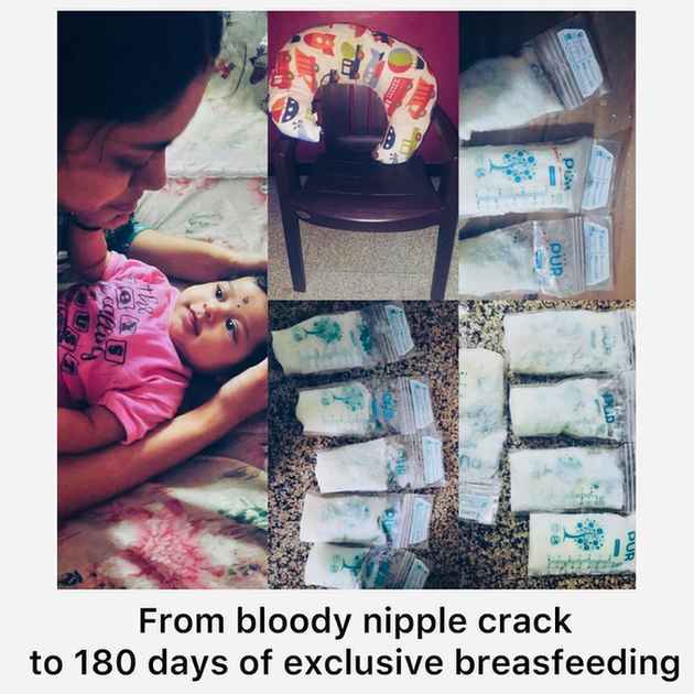 Breastfeeding Journey: Sore and Cracked Nipples - ReigningStill